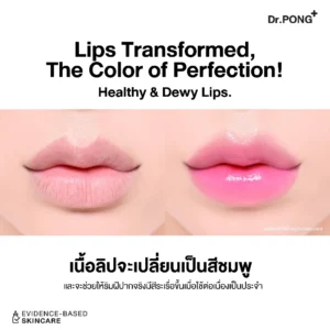 Dr.PONG 28D Whitening Drone Pinky Lip Mask – แก้ปากคล้ำ ปากชมพูอิ่ม | ริมฝีปากใส